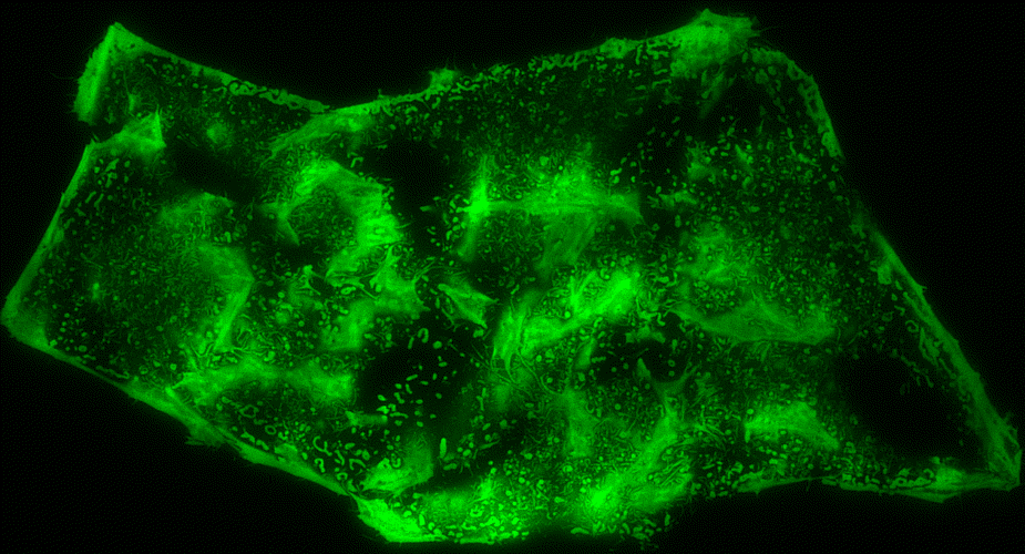 Cell Culture HeLa Cells Cells Communicated